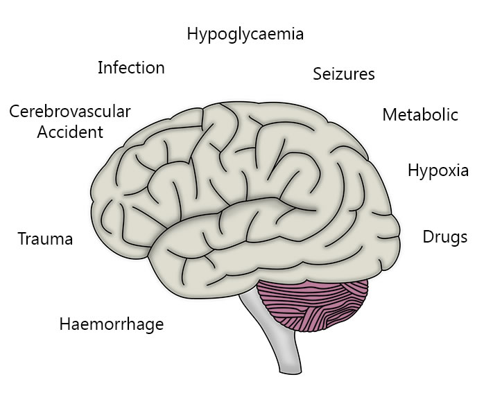 brain image