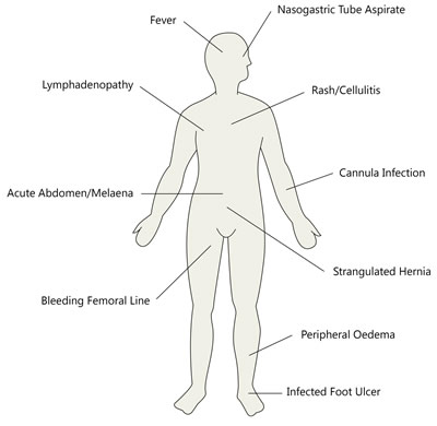 Cardiovascular shock and Obstructive shock