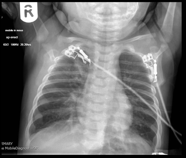 x-ray